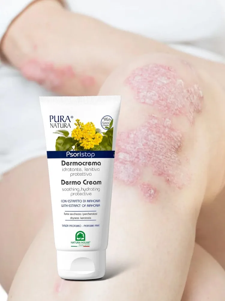 PSORISTOP DERMOCREMA Idratante Lenitiva Protettiva in caso di Psoriasi e Ipercheratosi - immagine 2